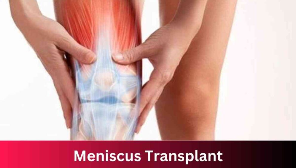 Meniscus Transplant